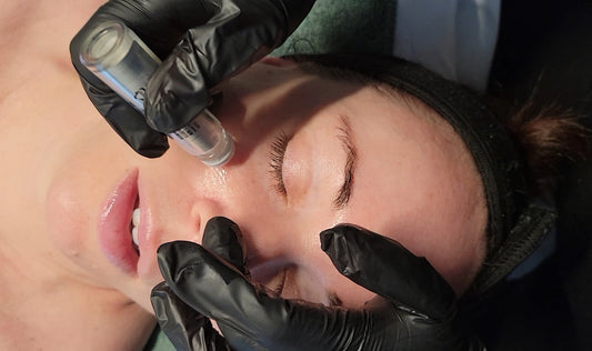 Microchanneling vs Microneedling: What's the Difference?