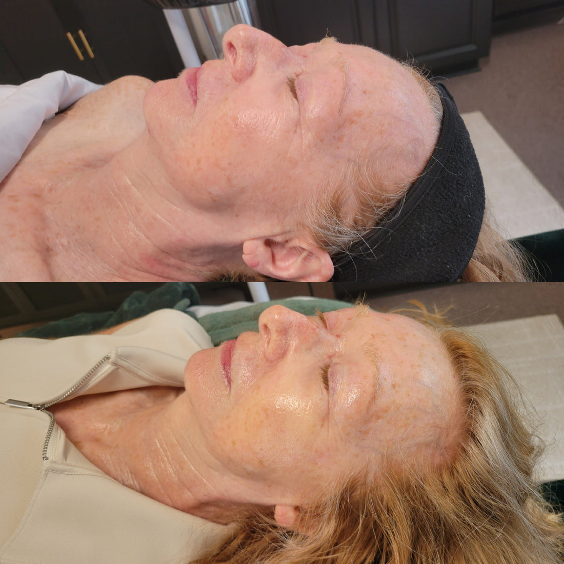 How to Support Skin to Slow Visible Signs of Aging